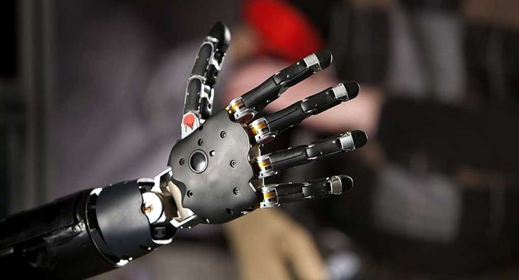 robotik el medikal prostetik